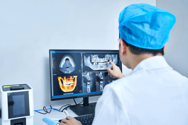 Best Emergency Wisdom Teeth Removal in Rockville Centre, NY